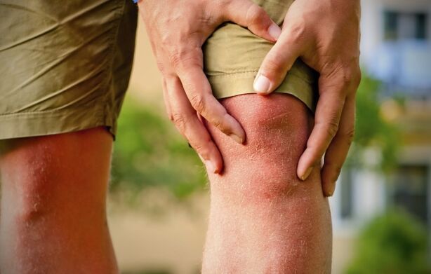Immagine clinica dell'osteoartrosi
