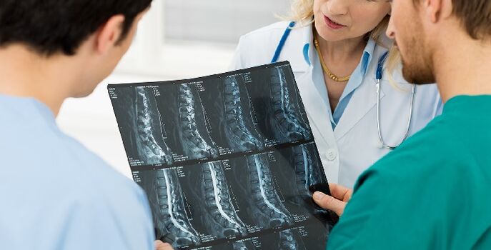 Radiografia della colonna vertebrale utilizzata per diagnosticare l'osteocondrosi