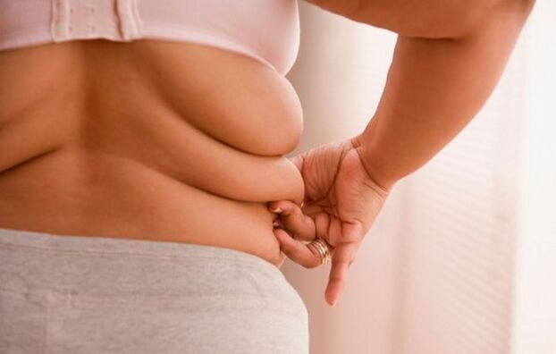 Obesità, causa dell'osteocondrosi cervicale nelle donne sotto i 40 anni di età
